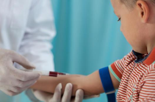 做哪些检查需要空腹？医生要求的空腹检查能喝水吗？