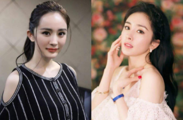 发际线高会秃顶吗 发际线高的人有什么烦恼