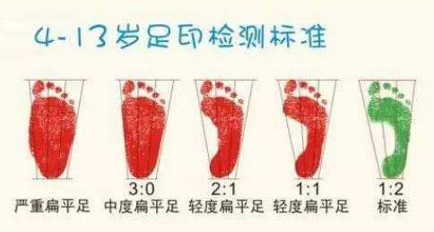 扁平足能跑步吗？扁平足跑步有什么危害？如何矫正