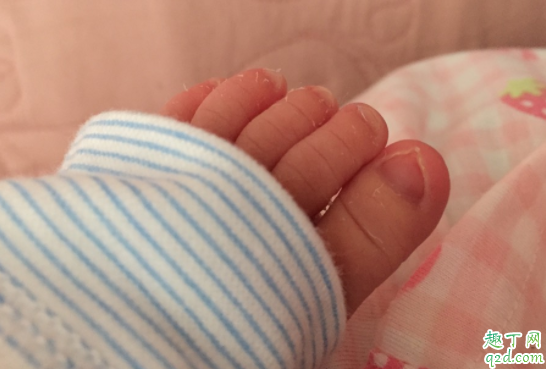 为什么宝宝生下来身上有好多白色的 宝宝身上的胎脂可以自己吸收吗