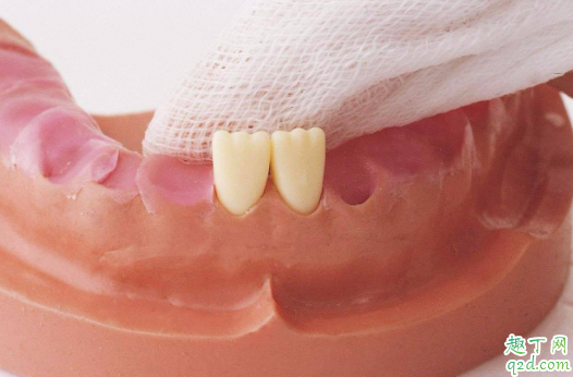 宝宝出牙会有低烧吗 小孩先长上牙还是下牙