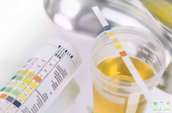 孕期不胖可以不做糖筛吗 糖筛什么时候做多少周