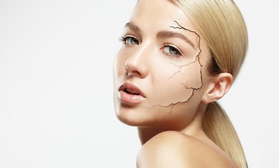 冬季皮肤干燥是怎么回事 皮肤干燥要怎么缓解推荐5大妙招