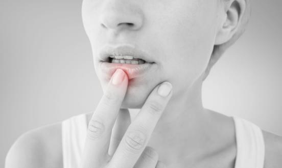 秋冬季节护唇小妙招 正确选择润唇膏轻松脱掉嘴唇小干屑