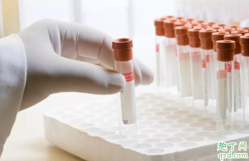 糖尿病多久可以治愈 糖尿病能彻底治好吗