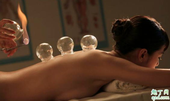 经常拔火罐能祛湿吗 拔罐时哪些事项要注意