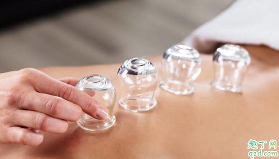 经常拔火罐能祛湿吗 拔罐时哪些事项要注意