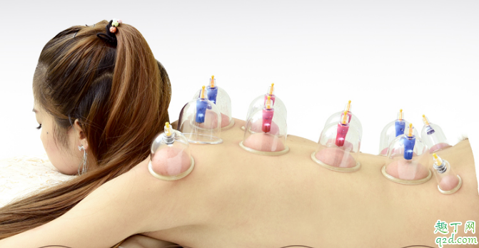 经期能不能拔火罐 拔火罐有哪些禁忌