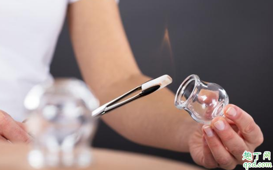 拔罐是不是时间越长越好 拔罐一般需要多长时间