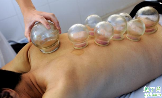 便秘拔罐有用吗 得了便秘的人能不能拔火罐