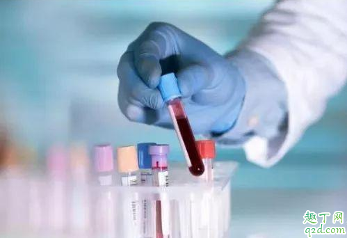 献血好不好 献血后有不良反应么