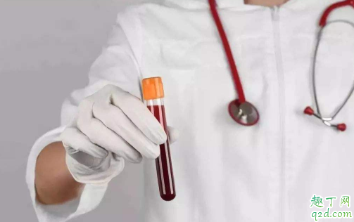 献血当时能查出艾滋吗 献血都能检测出什么病