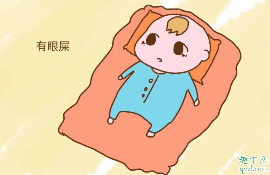 宝宝一直有眼泪眼屎怎么办 宝宝眼屎多是上火吗