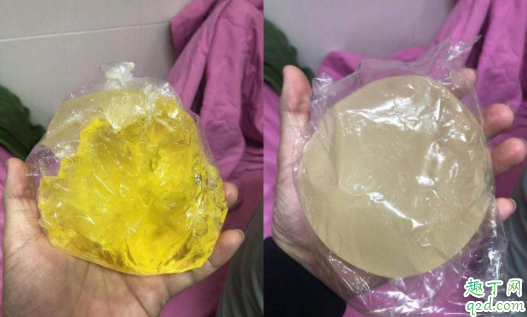 假体隆胸能不能哺乳 隆过胸了还能喂奶么