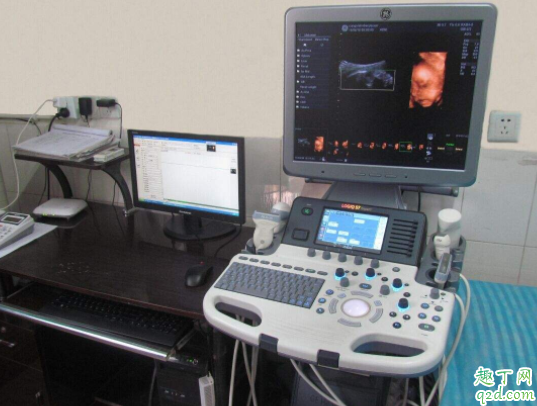 孕几周做四维是最佳时期 四维彩超几分钟做完