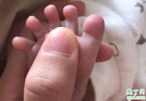 刚出生的小孩子怎么会得肺炎呢 孩子咳嗽发烧会不会是肺炎