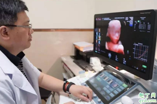 做四维能查出唐氏综合征吗 四维彩超排查哪些畸形