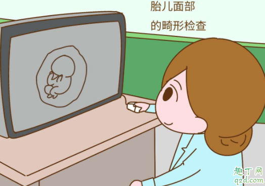 做四维能查出唐氏综合征吗 四维彩超排查哪些畸形