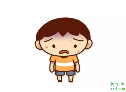 得了手足口病以后还会再得吗 平时怎么预防手足口