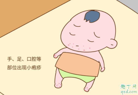 得了手足口病以后还会再得吗 平时怎么预防手足口