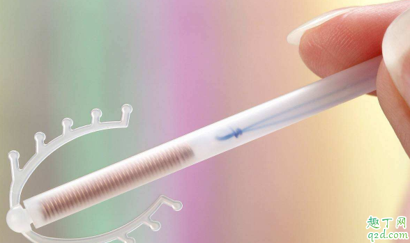 节育环能不能不取 节育环超期使用会怎样