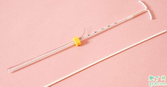 节育环能不能不取 节育环超期使用会怎样