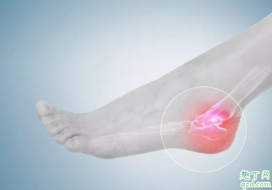脚踝扭伤为什么恢复得慢 脚崴到怎么应急处理