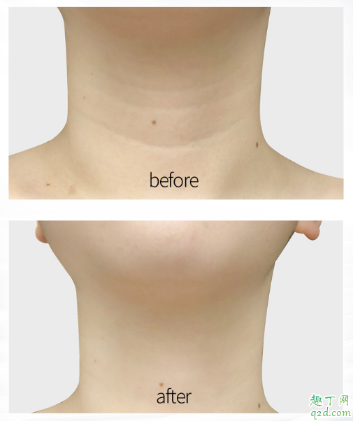 悦芙媞颈霜效果怎么样 抖音悦芙媞颈霜使用评测