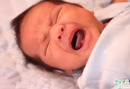 宝宝胎毛剃好还是不剃好 宝宝胎毛要剃光吗还是留一点