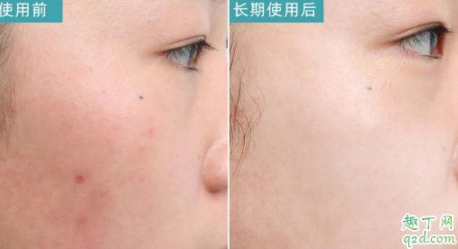 D18净透修护精华液好用吗 D18净透修护精华液使用测评