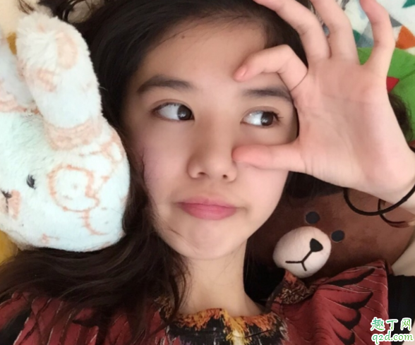 眼压高马上会得青光眼吗 青光眼隔几代遗传