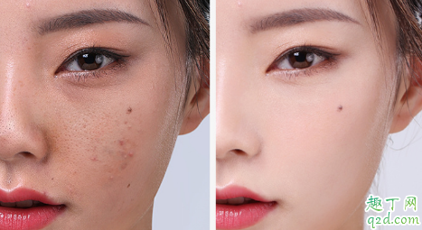 素萃黑醋面膜好用吗 素萃黑醋面膜使用测评