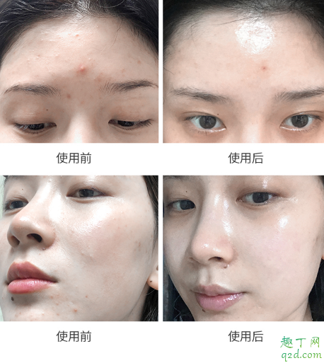 科娜蓝面霜好用吗 科娜蓝面霜使用评测