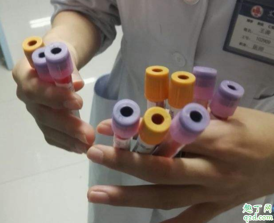 乙肝检测要空腹抽血吗 医院抽血是不是多抽了