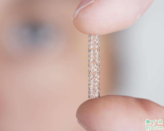 装了心脏支架还可以取出来吗 心脏支架有害处吗