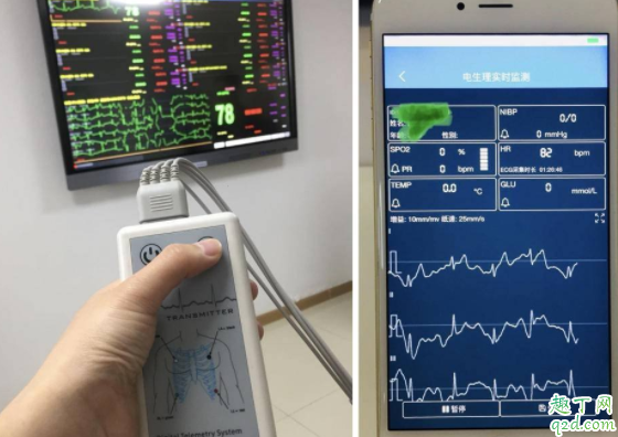 心电图异常是心脏病吗 心电图检查心肌梗死准确吗