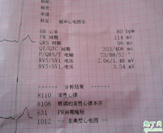 体检心律不齐有危险吗 心电图窦性心律不齐有什么危害