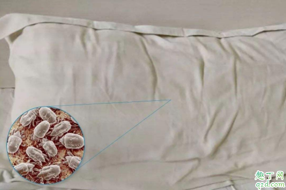 尘螨是螨虫吗 尘螨过敏鼻炎怎么治疗