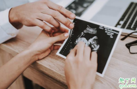 怀孕30周+2想引产可以吗 怀孕30周+2引产对女性的危害大吗