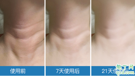 米加颈霜有没有效果 米加颈霜使用评测