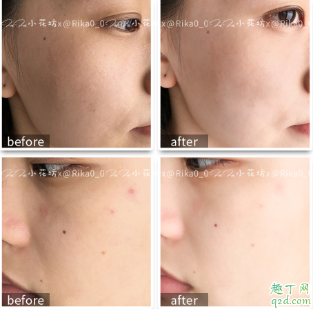 贝欧梦特谷胱甘肽美白精华怎么样 贝欧梦特美白精华使用感受