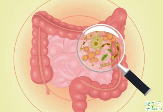 肠道癌如何预防 肠癌有什么症状