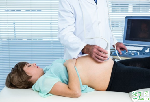四维彩超一个人能做吗 做四维彩超要人陪吗