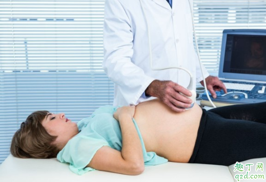 四维彩超照片是胎儿的真实长相吗 四维彩超的照片跟生出来一样的吗