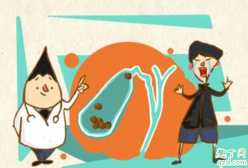 胆结石能自己化掉吗 胆结石有什么症状