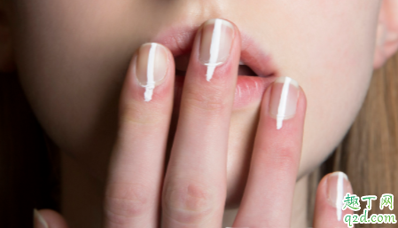 压力大会造成指甲竖纹吗 生活习惯会影响指甲竖纹吗
