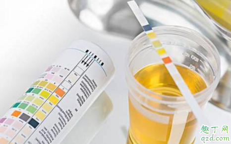 尿蛋白一加一减要紧吗 蛋白尿多少属于危险值