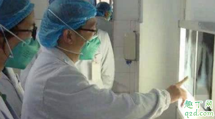 新型冠状病毒多久会发病 新型冠状病毒非典型症状有什么