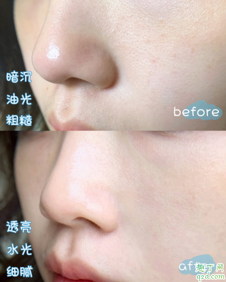 兰蔻极光水敏感肌可以用吗 兰蔻极光水适合什么皮肤及年龄