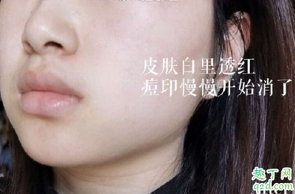 博乐达烟酰胺精华好用吗 博乐达烟酰胺精华使用测评